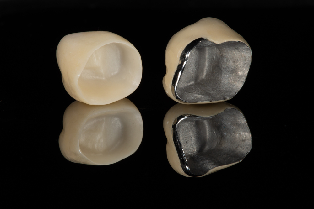 How Much Does a Tooth Crown Cost In Australia?