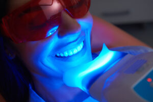 Teeth whitening cost